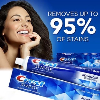 Kem đánh răng Crest 3D White Advanced Triple Whitening 158g trắng răng bảo vệ chống lại sâu răng