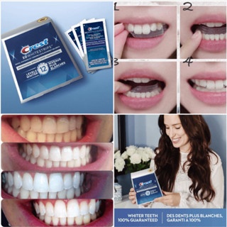 Tách lẻ 1 miếng dán Crest 3D Whitestrips Levels 12 làm trắng răng tiện lợi dễ sử dụng