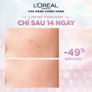 Kem dưỡng Loreal Paris Glycolic-Bright Glowing Cream 50ml sáng mịn mờ thâm nám ngày và đêm