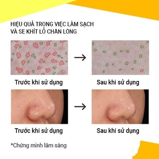 Mặt nạ đất sét Innisfree Super Volcanic Pore Clay Mask 2X 100ml giúp loại bỏ bã nhờn cho da sáng mịn