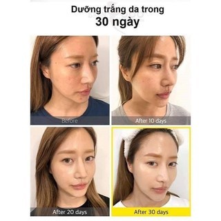 Serum Some By Mi Yuja Niacin Blemish Care 50ml hỗ trợ sáng da mờ vết thâm