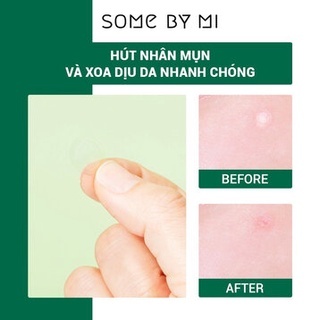 Miếng dán mụn Some By Mi Clear Spot Patch 18 miếng giảm mụn sau 8 giờ