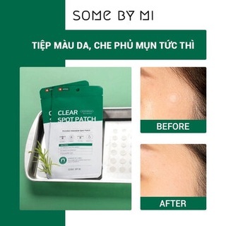 Miếng dán mụn Some By Mi Clear Spot Patch 18 miếng giảm mụn sau 8 giờ