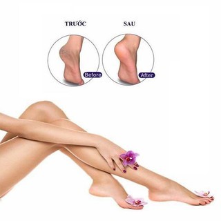 Chà gót chân Vacosi P02 loại bỏ các vùng da chai sần, giúp bạn có một đôi chân mềm mại hơn