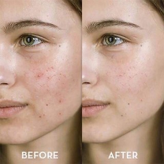 Serum chống lão hóa The Ordinary Retinol 1% in Squalane 30ml cấp ẩm ngăn ngừa lão hóa