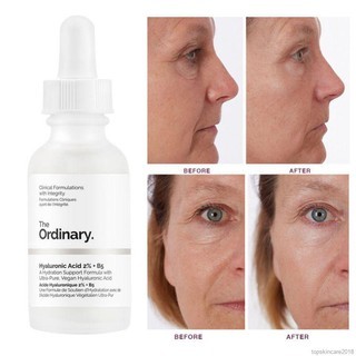 Serum The Ordinary Hyaluronic Acid 2% + B5 30ml 60ml giúp cấp nước và phục hồi da