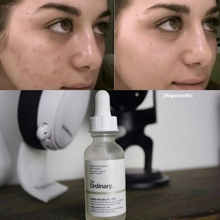Serum The Ordinary Alpha Arbutin 2% + HA 30ml dưỡng trắng giảm thâm nám