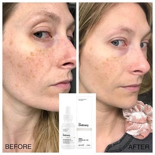 Serum The Ordinary Alpha Arbutin 2% + HA 30ml dưỡng trắng giảm thâm nám