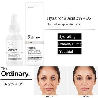 Serum The Ordinary Hyaluronic Acid 2% + B5 30ml 60ml giúp cấp nước và phục hồi da