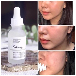 Serum The Ordinary Hyaluronic Acid 2% + B5 30ml 60ml giúp cấp nước và phục hồi da