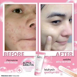 Sữa rửa mặt Alpha Arbutin Collagen Foaming Cleanser 120ml cho làn da sáng mịn