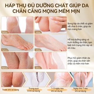 Mặt nạ chân Lanbena Foot Peel Mask 40ml dưỡng ẩm loại bỏ lớp da chết xỉn màu