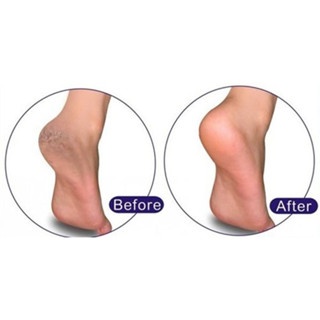 Kem ngừa nứt gót chân Thorakao 50g dưỡng ẩm và bảo vệ gót chân hiệu quả
