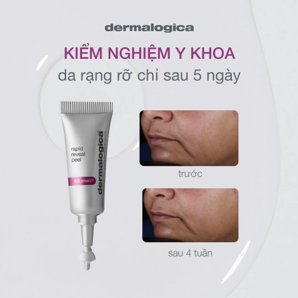 (Tách set) Kem tẩy da chết Dermalogica Rapid Reveal Peel 3ml