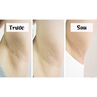 Xà phòng giảm thâm vùng nách Pelican Nhật Bản 80g giúp da luôn trắng mịn