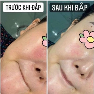 Mặt nạ SMAS Peptide Silk Mask 25g dưỡng và phục hồi da