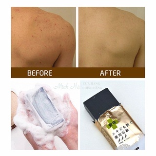 Xà phòng tắm Pelican For Back Medicated Soap 135g giảm mụn lưng