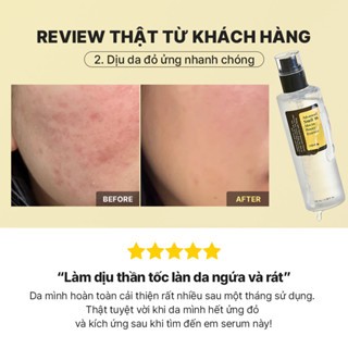 Huyết thanh Cosrx Advanced Snail 96 Mucin Power Essence 100ml cải thiện độ đàn hổi, ngăn ngừa lão hóa