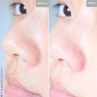 Mặt nạ thiên nhiên dưỡng da I'm From Mask 30g làm dịu mát da tức thì và tẩy da chết