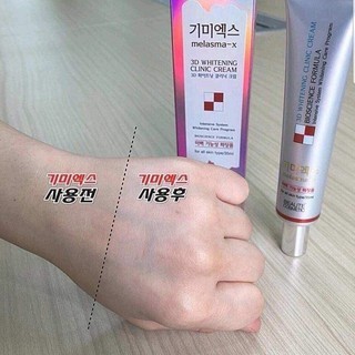 Kem dưỡng Melasma-X 3D Whitening Clinic Cream 40g giúp làm trắng da và giảm nám tàn nhang