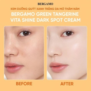 Kem dưỡng quýt xanh Bergamo Green Tangerin Vita Shine Dark Spot 50g sáng da mờ thâm nám