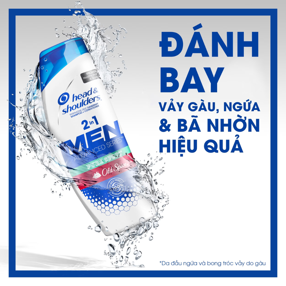 Dầu gội xả Head & Shoulders 2in1 370ml làm sạch da đầu loại bỏ gàu hiệu quả