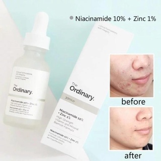Serum Ordinary Niacinamide 10 Zinc 1% 30/60ml giúp sáng da mờ thâm mụn