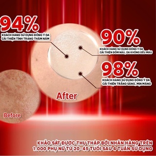 Kem dưỡng nám Angel’s Liquid Tranexamic Mela Cream 50ml mờ nám chuyên sâu