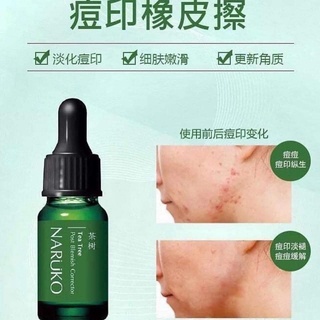 Tinh dầu chấm mụn Naruko Tea Tree Purifying Essential Oil 10ml giảm mụn, kiểm soát dầu