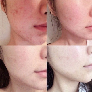 Sữa rửa mặt tràm trà Naruko Tea Tree Purifying Clay Mask & Cleanser 120g cho da dầu mụn làm sạch sâu, cân bằng dầu