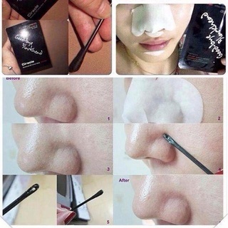Mặt nạ đẩy mụn đầu đen Ciracle Goodbye Blackhead 5ml sạch mụn đầu đen không hề gây đau rát