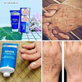 Kem dưỡng da tay KPEM Nga chống nhăn tay 50/100ml làm mờ đồi mồi cho đôi tay trắng sáng
