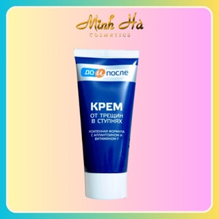 Kem làm giảm nứt nẻ gót chân KPEM 50ml hàng nội địa Nga mềm da dưỡng da mềm mịn