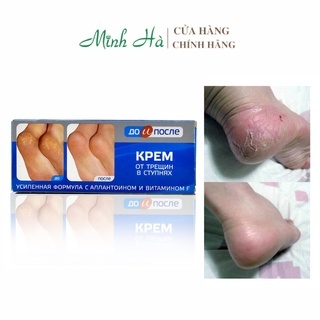 Kem làm giảm nứt nẻ gót chân KPEM 50ml hàng nội địa Nga mềm da dưỡng da mềm mịn
