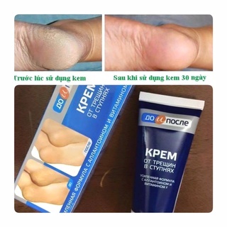 Kem làm giảm nứt nẻ gót chân KPEM 50ml hàng nội địa Nga mềm da dưỡng da mềm mịn