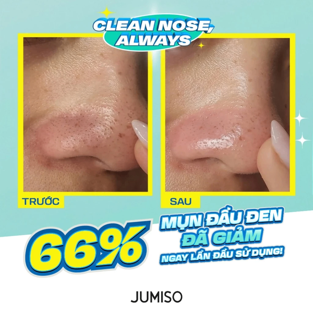 Tinh chất ủ mụn đầu đen Jumiso Blackhead Melting Softener Special Kit 150ml