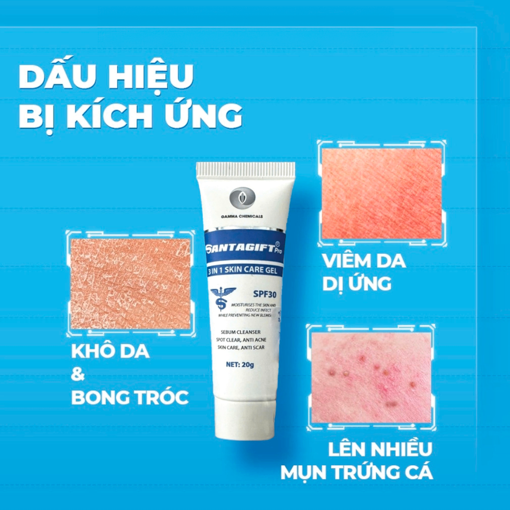 Kem giảm mụn SANTAGIFT 3 in 1 Skin Care Gel SPF30 20g giảm mụn, dưỡng da, chống nắng