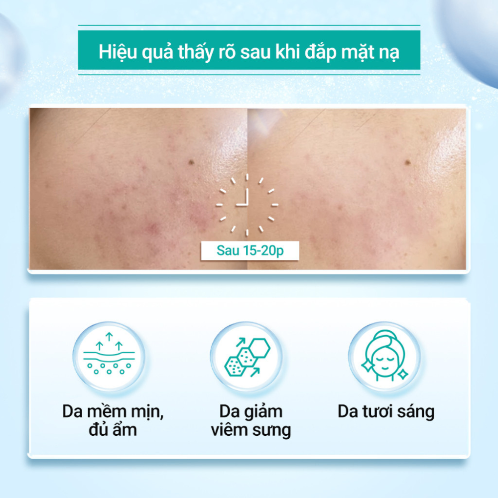 Mặt nạ Keyshu Centella Fiber Bioessence Mask