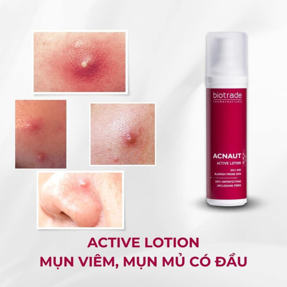 Chấm mụn Biotrade Acnaut Active Cream 15ml giảm mụn bọc mụn viêm mụn nội tiết