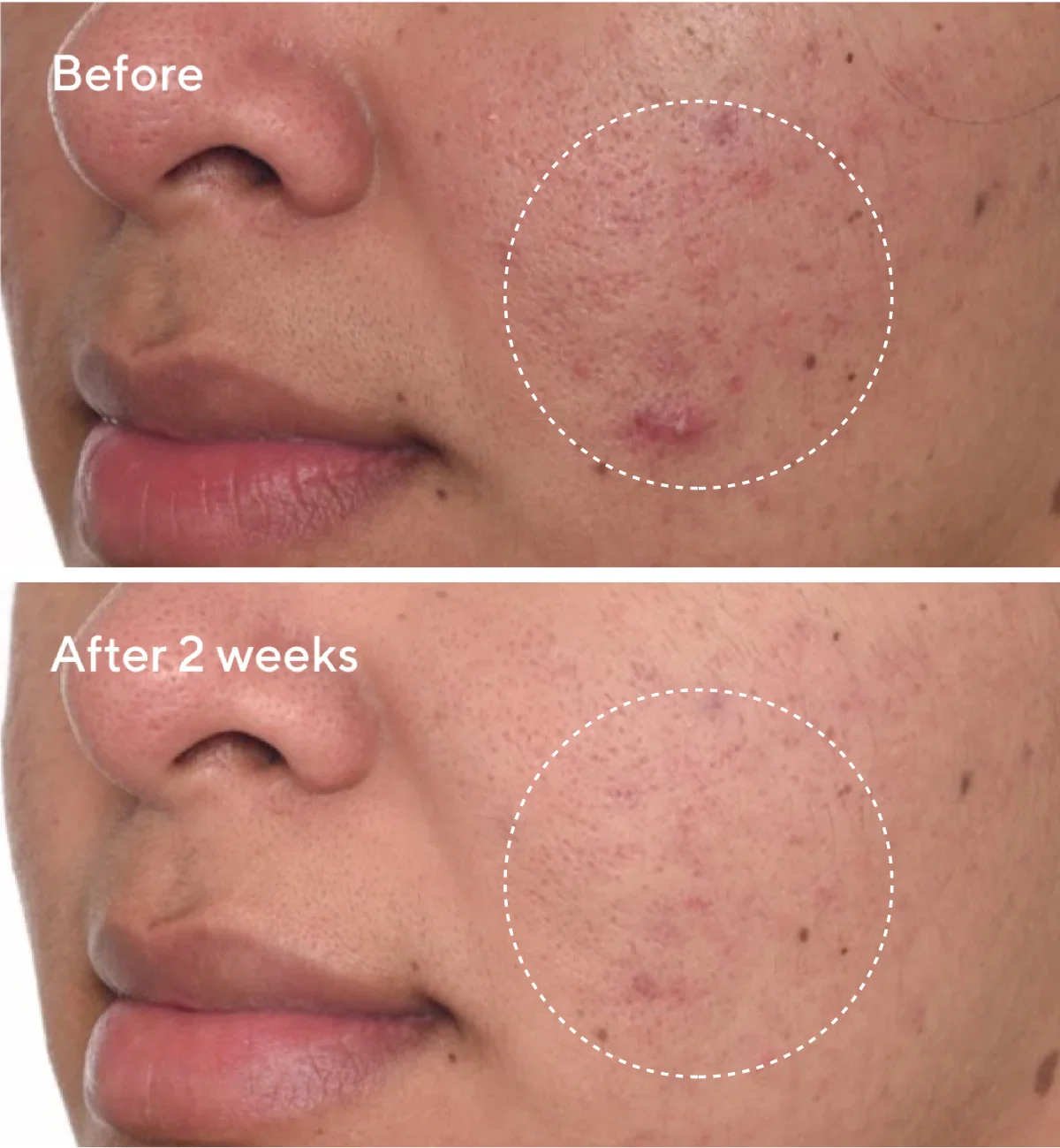 Tinh chất Murad Rapid Dark Spot Correcting Serum 30ml