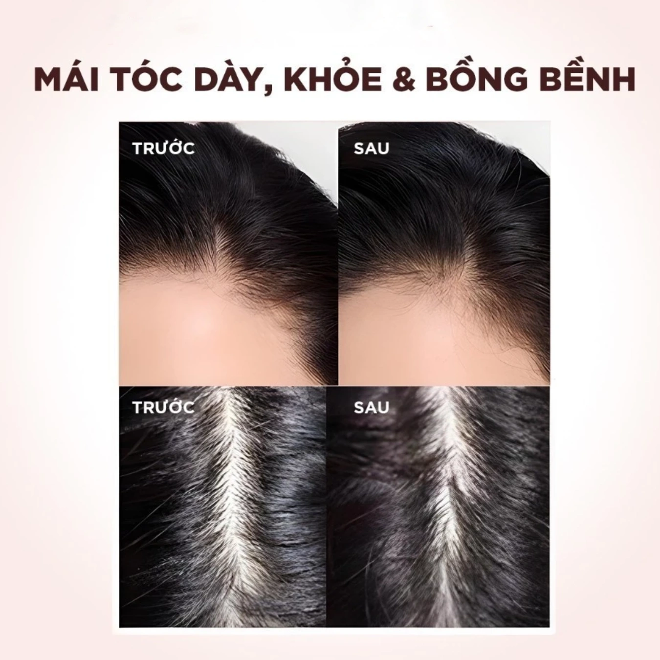 Dầu xả Loreal Full Resist Detangling Conditioner 440ml