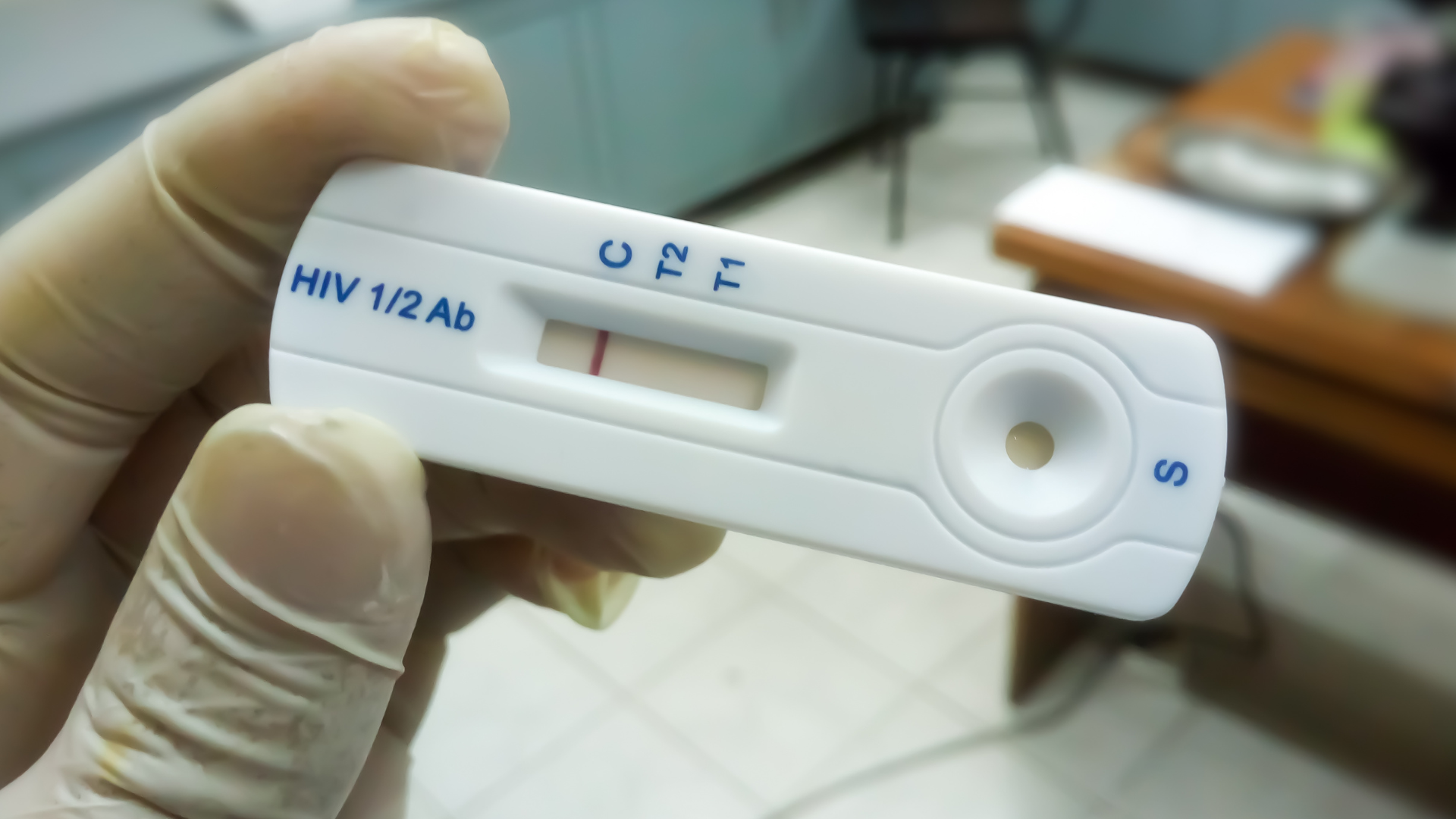 Nhung-yeu-to-anh-huong-den-ket-qua-test-nhanh-ban-can-biet_Các loại que xét nghiệm HIV tại nhà có đảm bảo chính xác không.png
