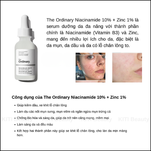 Tinh chất trị mụn thâm The Ordinary Niacinamide 10% + Zinc 1% (30ml)