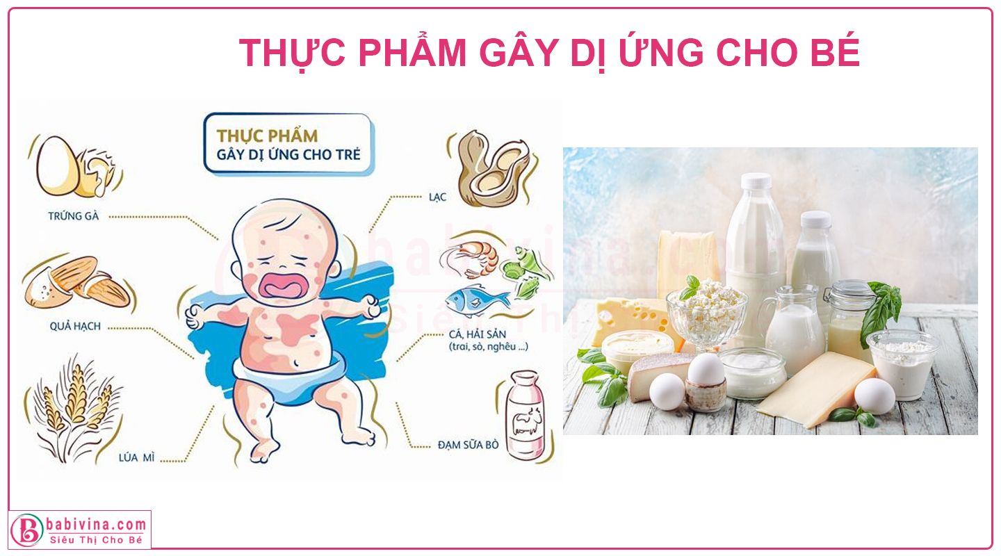 thực phẩm dễ gây dị ứng cho bé