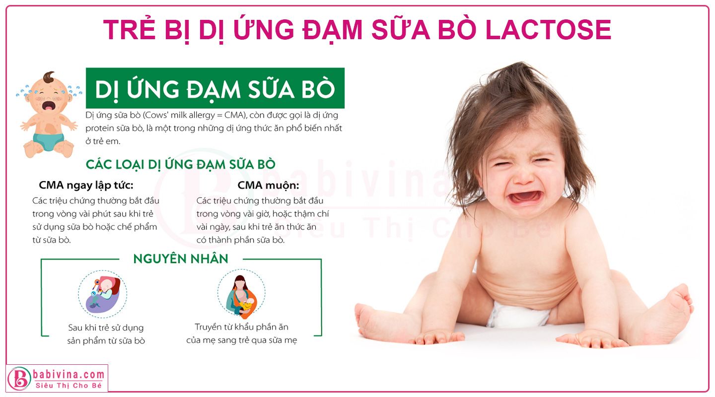 Làm gì khi trẻ bị dị ứng đạm sữa bò? Giải pháp hiệu quả và an toàn cho cha mẹ