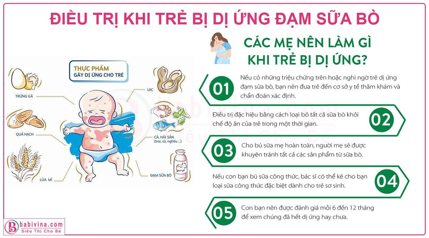 Cách điều trị khi bé dị ứng đạm sữa bò