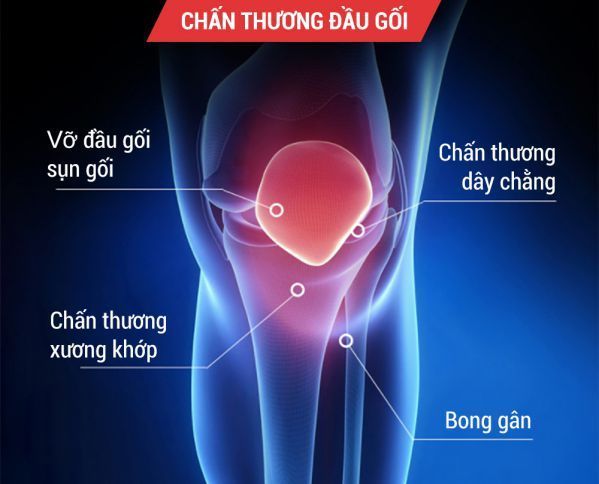 Bảo vệ đầu gối khỏi những tổn thương trong quá trình thi đấu