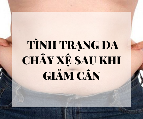 Nguyên nhân và các biện pháp khắc phục tình trạng da chảy xệ sau khi giảm cân