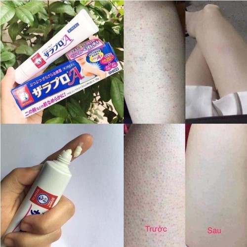 Kem viêm nang lông Zaraporo Rohto Nhật Bản 35g