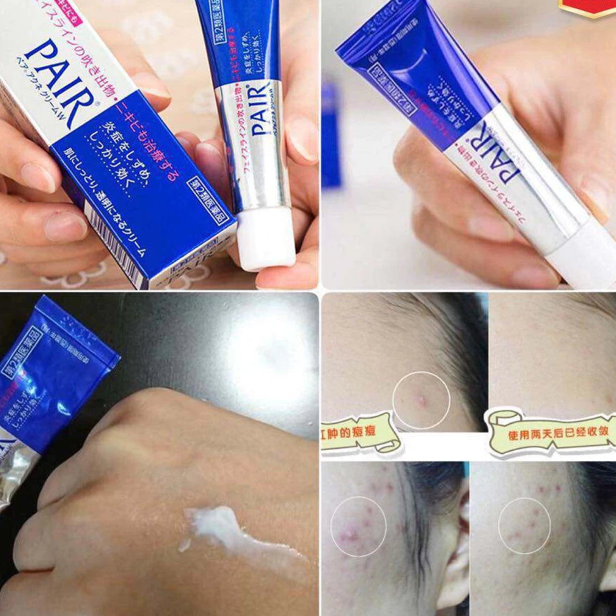 Kem trị mụn PAIR Nhật Bản 24gr (100/th)